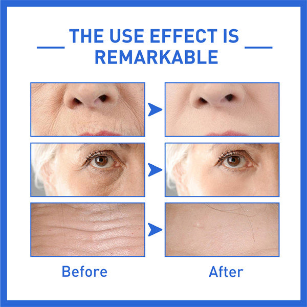 Last Day Promotion 70% OFF - š„2023 New Collagen Boost Permanent Anti-Aging Serum