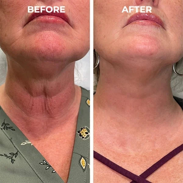 Olavita Serum